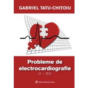PROBLEME DE ELECTROCARDIOGRAFIE (1-151) imagine