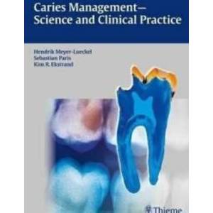 Caries Science Clinical Practice imagine