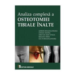 Analiza complexa a Osteotomiei Tibiale Inalte - Serban Dragosloveanu imagine