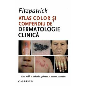 Fitzpatrick. Atlas color si compendiu de dermatologie clinica - Klaus Wolff imagine