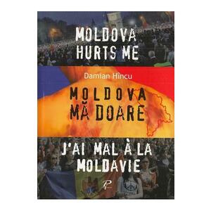 Moldova ma doare - Damian Hincu imagine