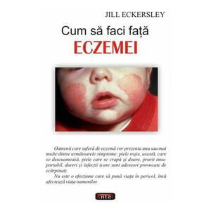 Cum sa faci fata eczemei - Jill Eckersley imagine