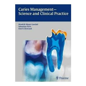 Caries Management - Science and Clinical Practice imagine
