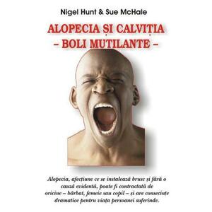 Alopecia si calvitia - Nigel Hunt, Sue Mchale imagine