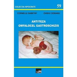Antiteza omfalocel gastroschizis - Corneliu Sabetay, Ovidiu Ciobanu imagine