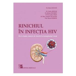 Rinichiul in infectia HIV. De la boala cronica de rinichi la transplantul renal - Dr. Oana Ailioaie imagine