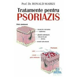 Tratamente pentru psoriazis - Ronald Marks imagine