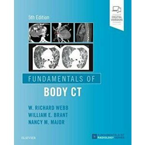 Fundamentals of Body CT, Paperback - W. Richard Webb imagine