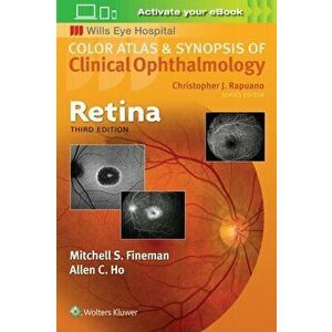 Retina, Paperback - Mitchell Fineman imagine