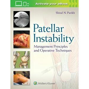Patellar Instability. Management Principles and Operative Techniques, Hardback - *** imagine