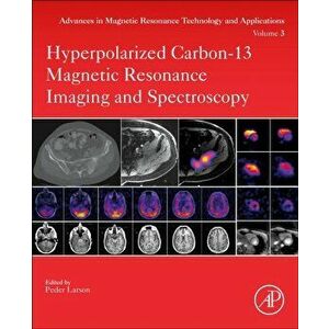 Hyperpolarized Carbon-13 Magnetic Resonance Imaging and Spectroscopy, Paperback - *** imagine
