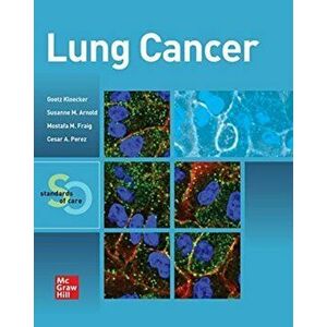 Lung Cancer: Standards of Care, Paperback - Cesar A. Perez imagine