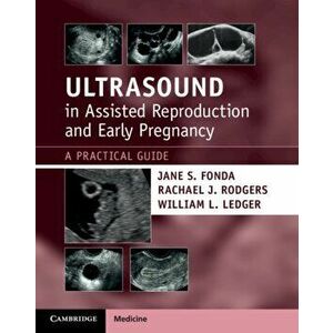 Ultrasound in Assisted Reproduction and Early Pregnancy. A Practical Guide, Paperback - William L. Ledger imagine