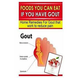 Foods You Can Eat If You Have Gout: Home Remedies for Gout That Work to Reduce Pain, Paperback - Doc Goodman imagine