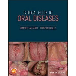 Clinical Guide to Oral Diseases, Paperback - Crispian Cbe Scully imagine