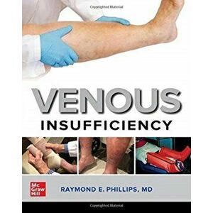 Venous Insufficiency, Paperback - Raymond E. Phillips imagine