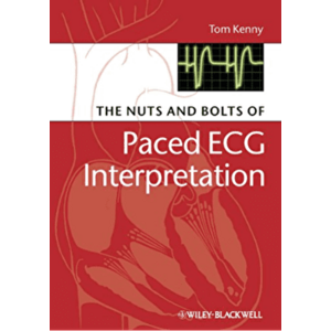 The Nuts and Bolts of Paced ECG Interpretation, Paperback - Tom Kenny imagine