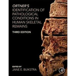 Ortner's Identification of Pathological Conditions in Human Skeletal Remains, Hardcover - Jane E. Buikstra imagine