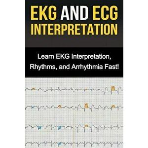 EKG and ECG Interpretation: Learn EKG Interpretation, Rhythms, and Arrhythmia Fast!, Paperback - Alyssa Stone imagine