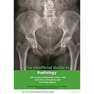 The Unofficial Guide to Radiology: 100 Practice Orthopaedic X Rays with Full Colour Annotations and Full X Ray Reports, Paperback - Alexander Young imagine