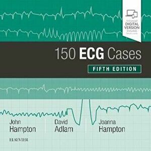 150 ECG Cases, Paperback - John Hampton imagine