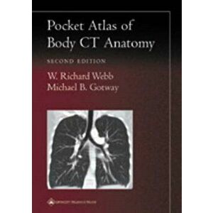 Pocket Atlas of Body CT Anatomy, Paperback - Michael B. Gotway imagine