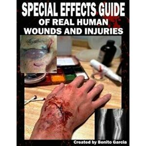Special Effects Guide of Real Human Wounds and Injuries: Special Effects Guide of Real Human Wounds and Injuries, Paperback - Mr Benito Garcia III imagine