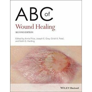 ABC of Wound Healing. 2nd Edition, Paperback - *** imagine