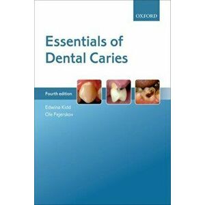 Essentials of Dental Caries, Paperback - Ole Fejerskov imagine