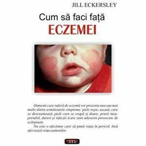Cum sa faci fata eczemei - Jill Eckersley imagine