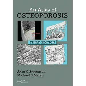 Atlas of Osteoporosis, Paperback - Michael S. Marsh imagine