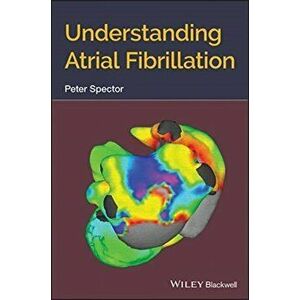 Understanding Atrial Fibrillation, Paperback - Peter Spector imagine