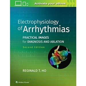 Electrophysiology of Arrhythmias. Practical Images for Diagnosis and Ablation, Hardback - Reginald T. Ho imagine