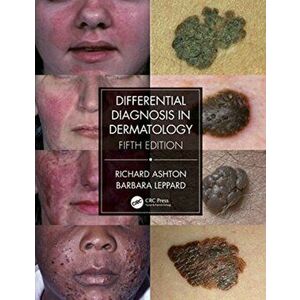Differential Diagnosis in Dermatology, Paperback - Barbara Leppard imagine