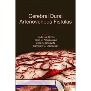 Cerebral Dural Arteriovenous Fistulas, Paperback - *** imagine