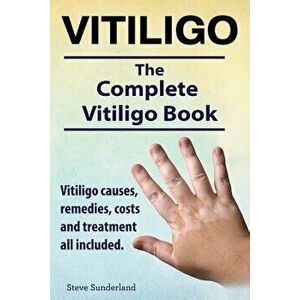 Vitiligo. Vitiligo Causes, Remedies, Costs and Treatment All Included. the Complete Vitiligo Book., Paperback - Steve Sunderland imagine