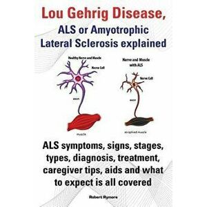 Lou Gehrig Disease, ALS or Amyotrophic Lateral Sclerosis Explained. ALS Symptoms, Signs, Stages, Types, Diagnosis, Treatment, Caregiver Tips, AIDS and imagine