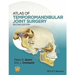 Atlas of Temporomandibular Joint Surgery, Hardback - *** imagine