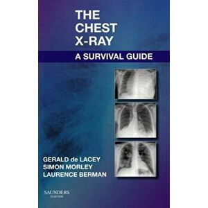 Chest X-Ray: A Survival Guide, Paperback - Laurence Berman imagine
