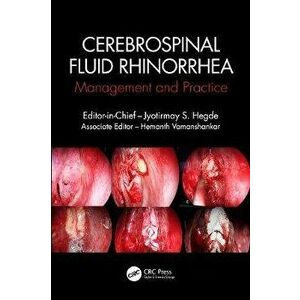 CSF Rhinorrhoea. Management and Practice, Paperback - *** imagine