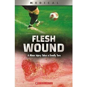 Flesh Wound (XBooks). A Minor Injury Takes a Deadly Turn, Paperback - Shea Phillips imagine