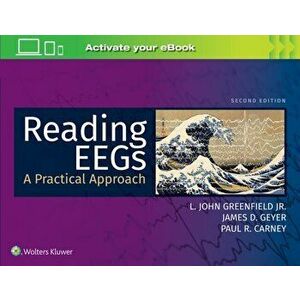 Reading EEGs: A Practical Approach, Paperback - James D. Geyer imagine