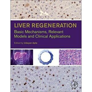 Liver Regeneration. Basic Mechanisms, Relevant Models and Clinical Applications, Hardback - *** imagine