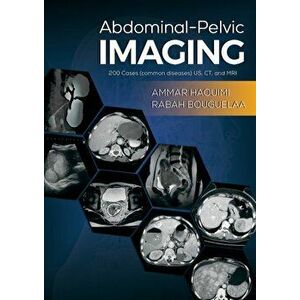 Abdominal-Pelvic Imaging. 200 Cases (Common Diseases): US, CT and MRI, Paperback - Rabah Bouguelaa imagine