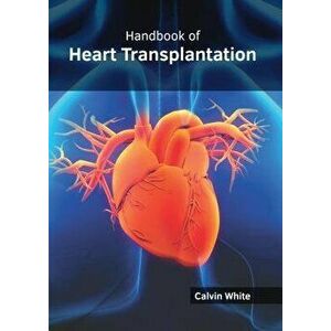 Handbook of Heart Transplantation, Hardcover - Calvin White imagine
