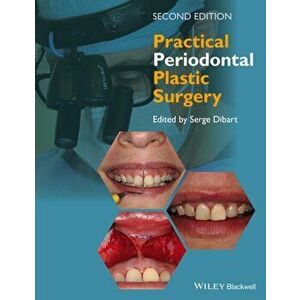 Practical Periodontal Plastic Surgery, Hardback - *** imagine