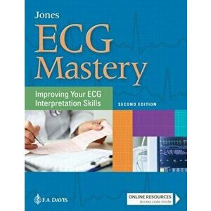 ECG Mastery. Improving Your ECG Interpretation Skills, Paperback - Shirley A. Jones imagine