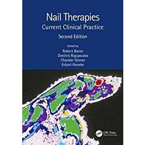 Nail Therapies. Current Clinical Practice, Paperback - *** imagine