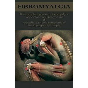 Fibromyalgia: The complete guide to fibromyalgia, understanding fibromyalgia, and reducing pain and symptoms of fibromyalgia with si, Paperback - Davi imagine