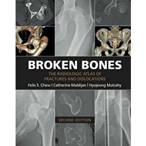 Broken Bones: The Radiologic Atlas of Fractures and Dislocations, Paperback - Felix S. Chew imagine